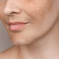 Pigmentation
