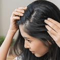 Hairfall