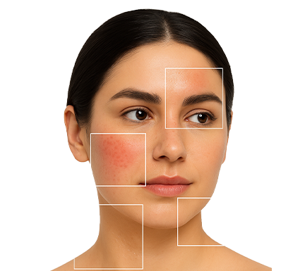 Finder Image