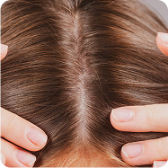 Hair Concerns