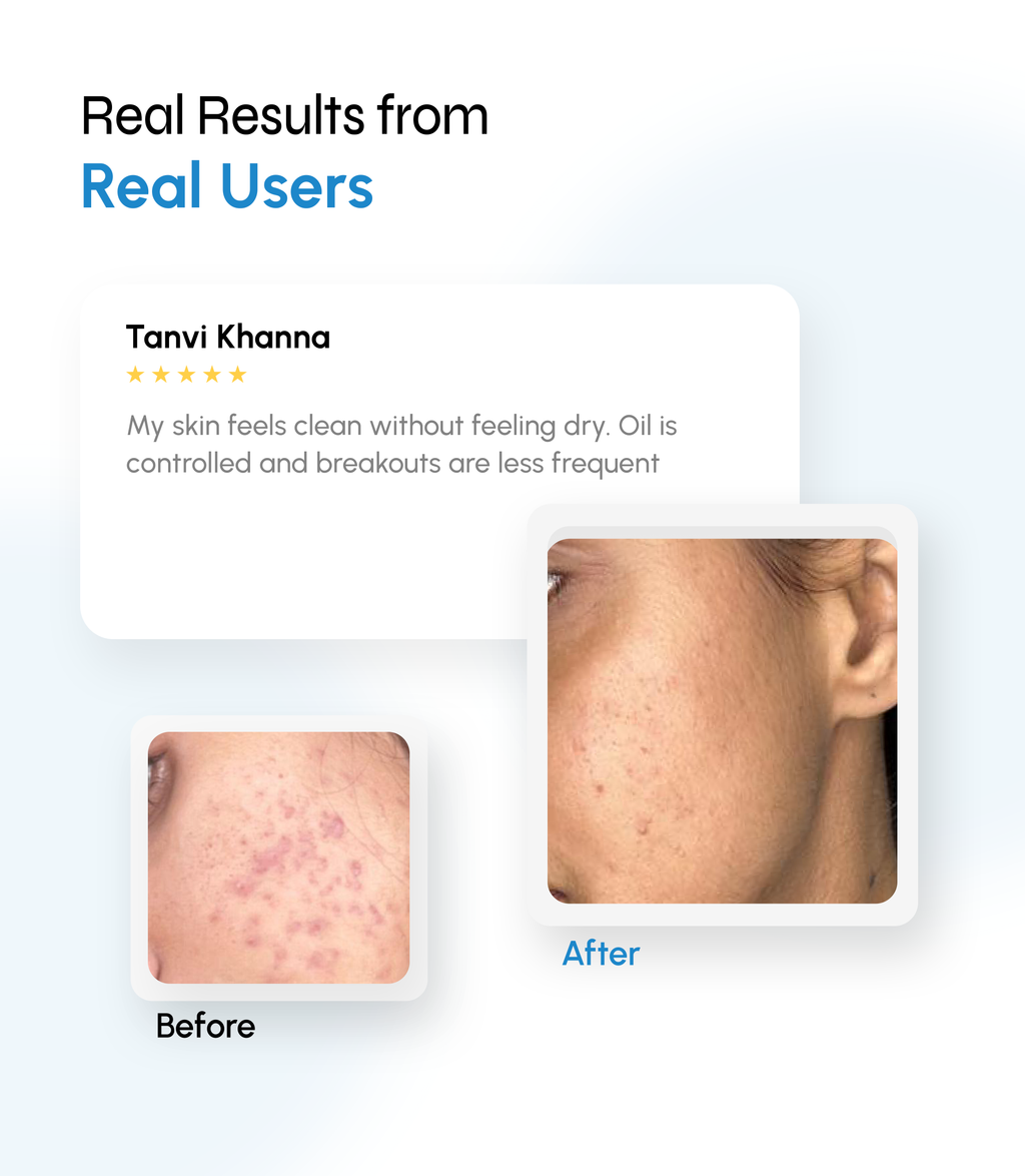 Acne Control & Purifying Cleanser