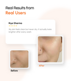 Advanced Brightening Face Cleanser with Hydration & Barrier Support