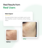 Bio Engineered Pigment Control Complex Cream