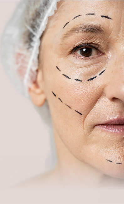 Fine lines and Wrinkles