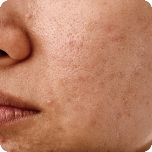 Dull Skin